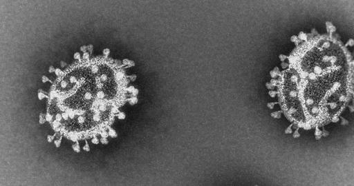 Corona virus SARS-Cov-2 visualization. View through microscope