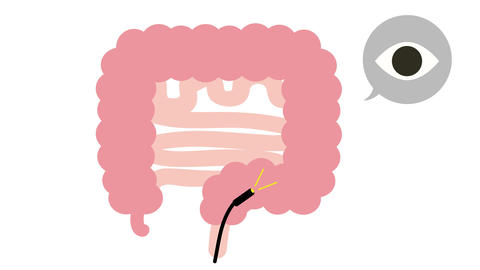 Cartoon Colonoscopy Scope