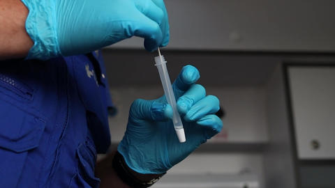 The doctor does an express test for a viral disease. Definition of the disease. medical testing
