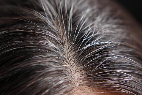 scalp parting close-up gray hair hair care macro photo
