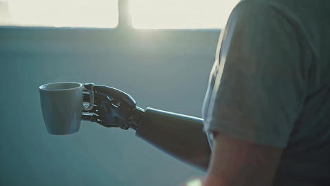 Hospital Patient Prosthetic Arm holding Coffee Cup Amputee Disability Rehabilitation Bionic Tech