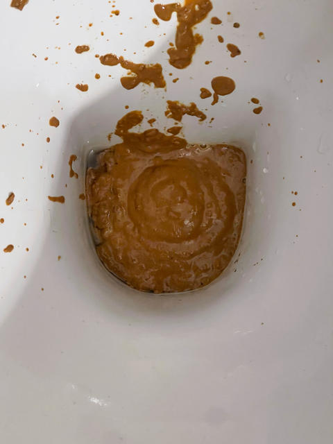 White toilet filled with human excrement