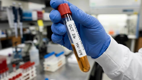 Scientist in a lab coat and blue gloves holding a test tube labeled Hantavirus in a clinical