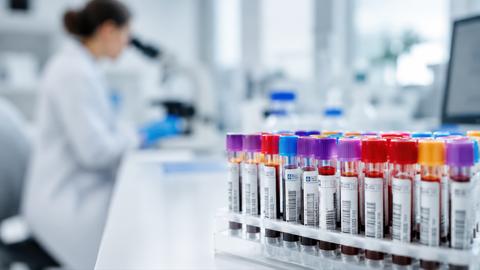 Laboratory work with blood samples