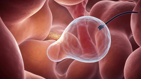 Medical nanoparticles delivered to cell