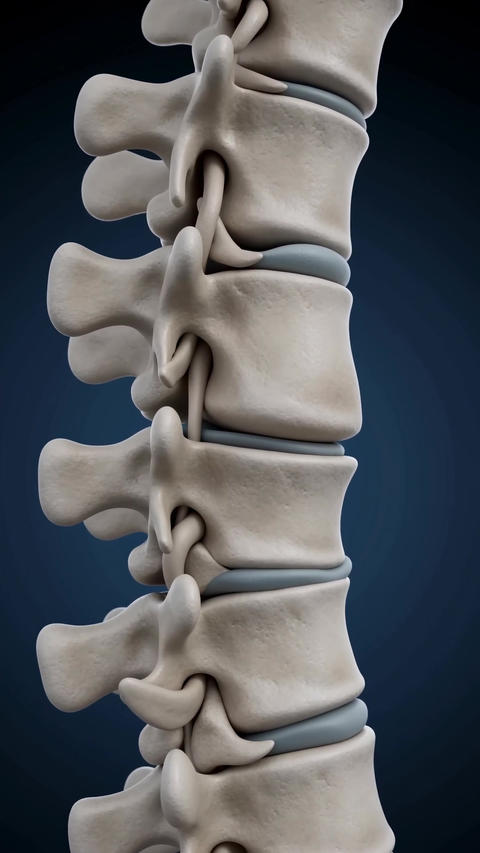 Medical lumbar spine herniated disc vertical